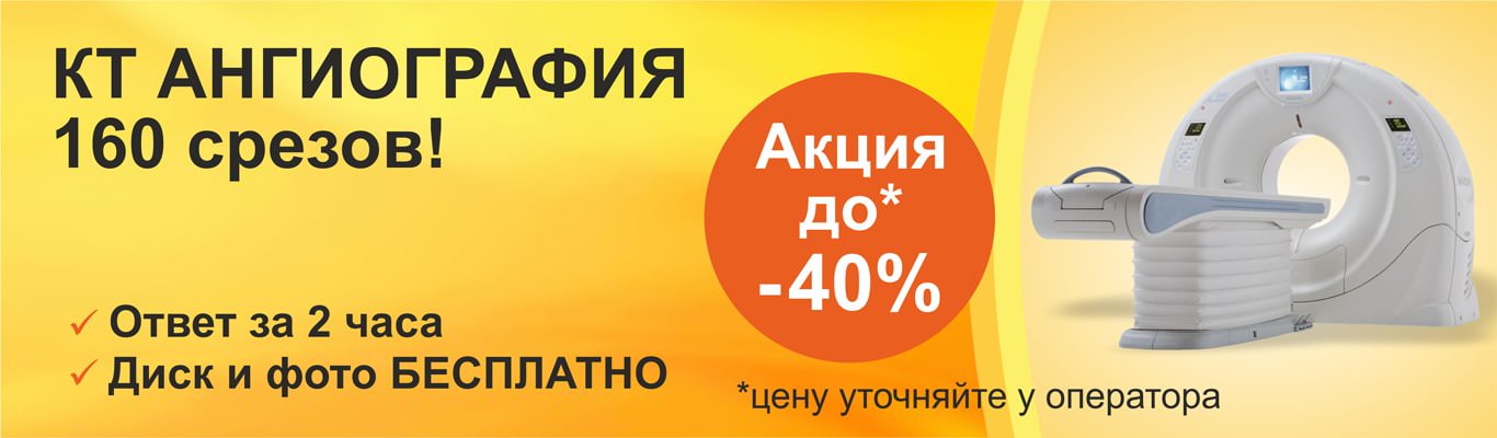 КТ ангиография КТ ангиография - фото 1