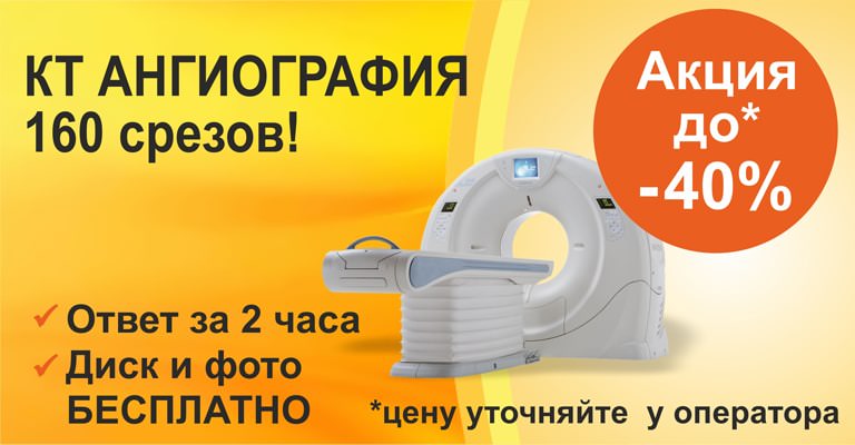 КТ ангиография КТ ангиография - фото 2