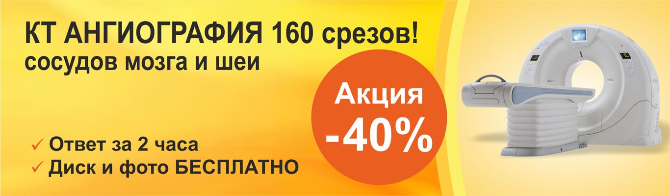 КТ-ангиография головы, мозга и шеи - Цена в Киеве | Добрый Прогноз КТ-ангиография головы, мозга и шеи - Цена в Киеве | Добрый Прогноз - фото 1