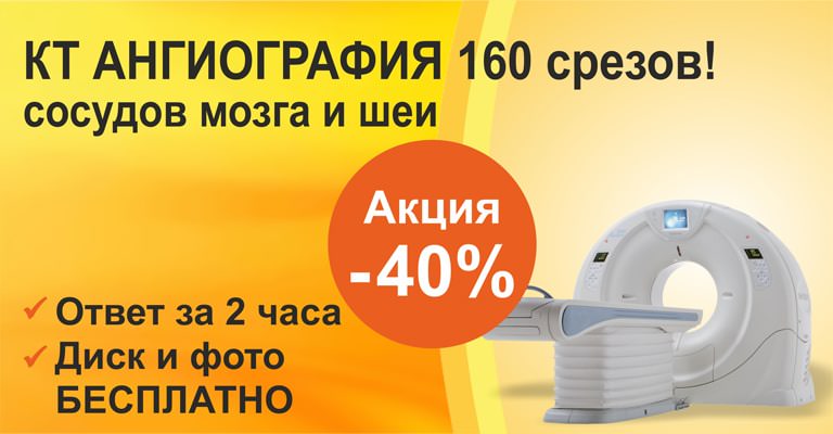КТ-ангиография головы, мозга и шеи - Цена в Киеве | Добрый Прогноз КТ-ангиография головы, мозга и шеи - Цена в Киеве | Добрый Прогноз - фото 2