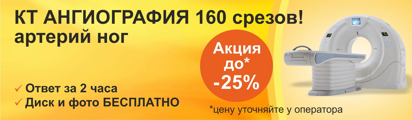 КТ-ангиография нижних конечностей - Цена в Киеве | Добрый Прогноз КТ-ангиография нижних конечностей - Цена в Киеве | Добрый Прогноз - фото 1