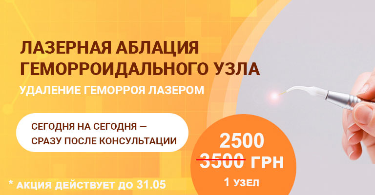 Лечение геморроя лазером в Киеве: цены и отзывы - Добрый Прогноз Лечение геморроя лазером в Киеве: цены и отзывы - Добрый Прогноз - фото 2