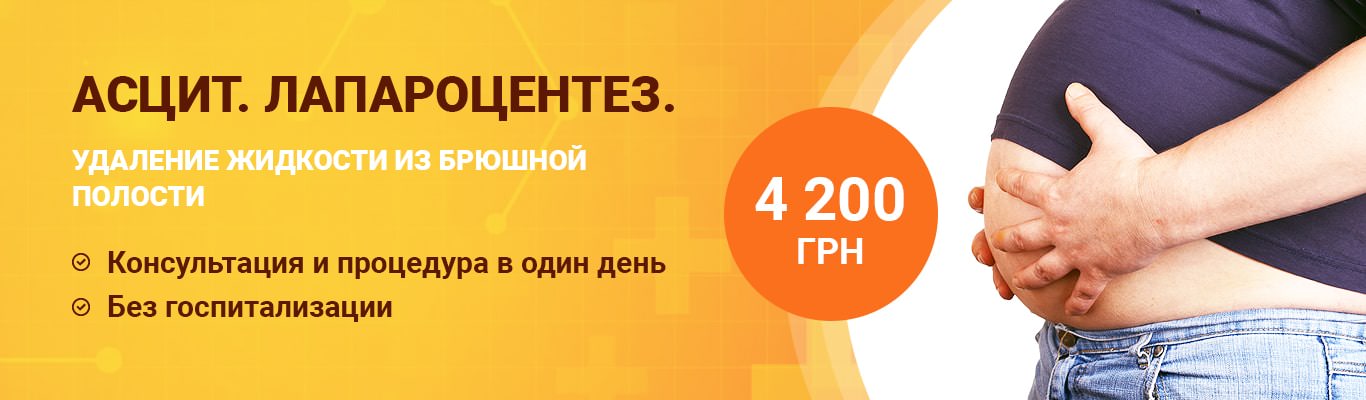 Что такое злокачественный асцит. Смотреть фото Что такое злокачественный асцит. Смотреть картинку Что такое злокачественный асцит. Картинка про Что такое злокачественный асцит. Фото Что такое злокачественный асцит