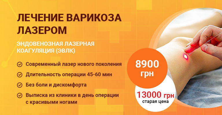 Лечение варикоза лазером (ЭВЛК) в Киеве: цены и отзывы - Добрый Прогноз Лечение варикоза лазером (ЭВЛК) в Киеве: цены и отзывы - Добрый Прогноз - фото 2