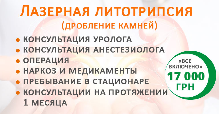 Лазерное дробление камней Лазерное дробление камней - фото 2