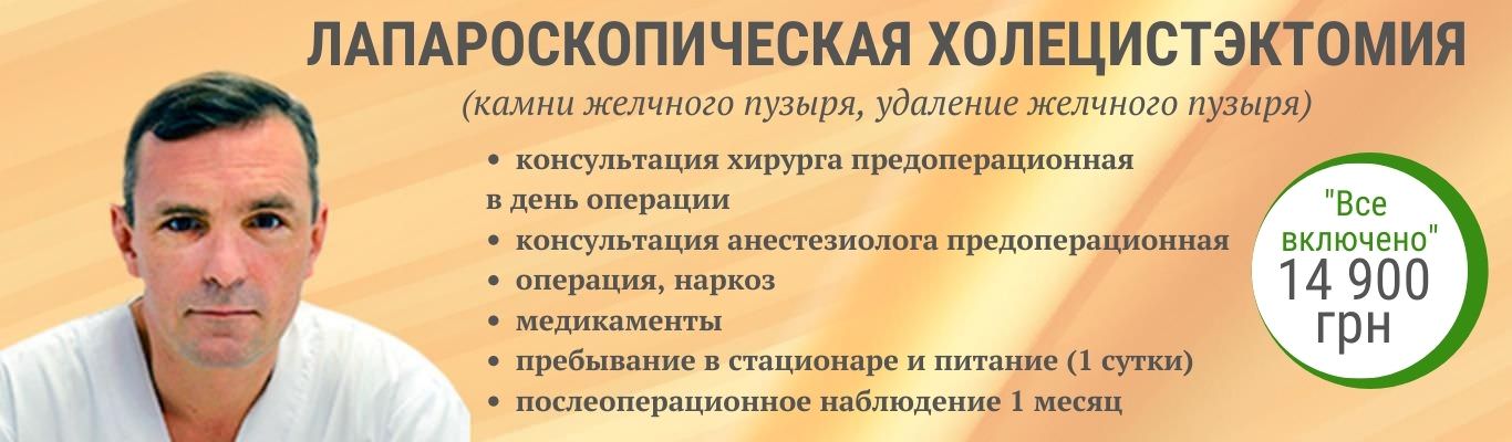 Холецистэктомия (удаление желчного пузыря) ᐈ лапароскопическая холецистэктомия в Киеве Холецистэктомия (удаление желчного пузыря) ᐈ лапароскопическая холецистэктомия в Киеве - фото 1