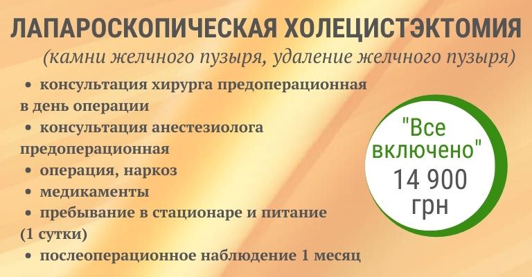 Холецистэктомия (удаление желчного пузыря) ᐈ лапароскопическая холецистэктомия в Киеве Холецистэктомия (удаление желчного пузыря) ᐈ лапароскопическая холецистэктомия в Киеве - фото 2