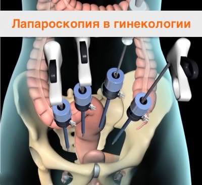 Лечение бесплодия в Киеве ᐈ у женщин ᐈ цена Лечение бесплодия в Киеве ᐈ у женщин ᐈ цена - фото 1