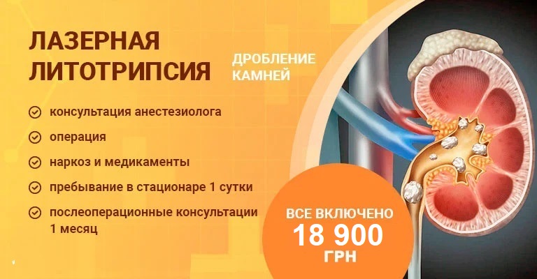 Анализ на ураты в моче в Москве цена в лаборатории ДНКОМ