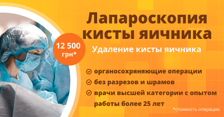 Лечение кисты яичника у женщин: цены, симптомы, причины – Санкт-Петербург.